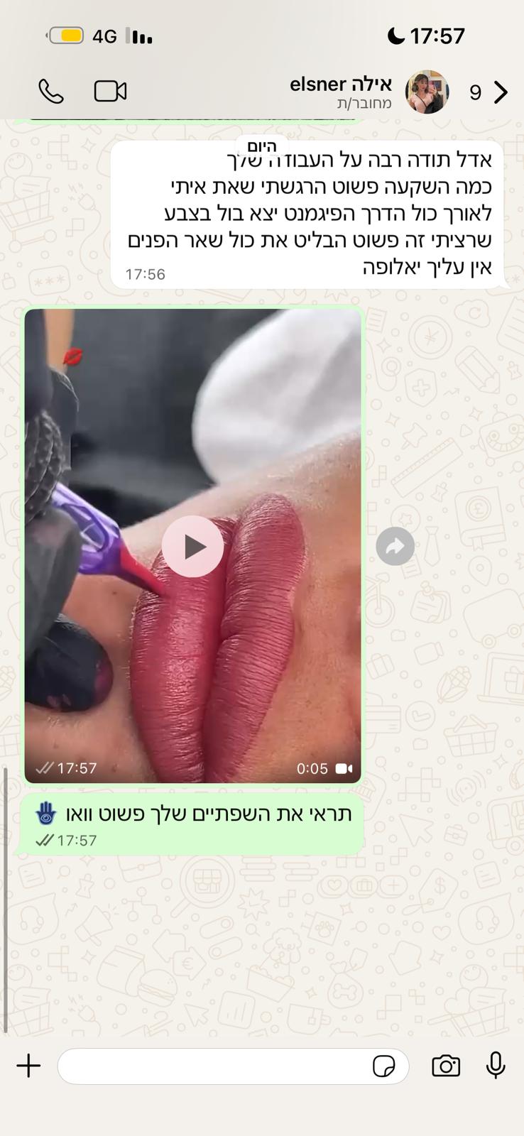 המלצה